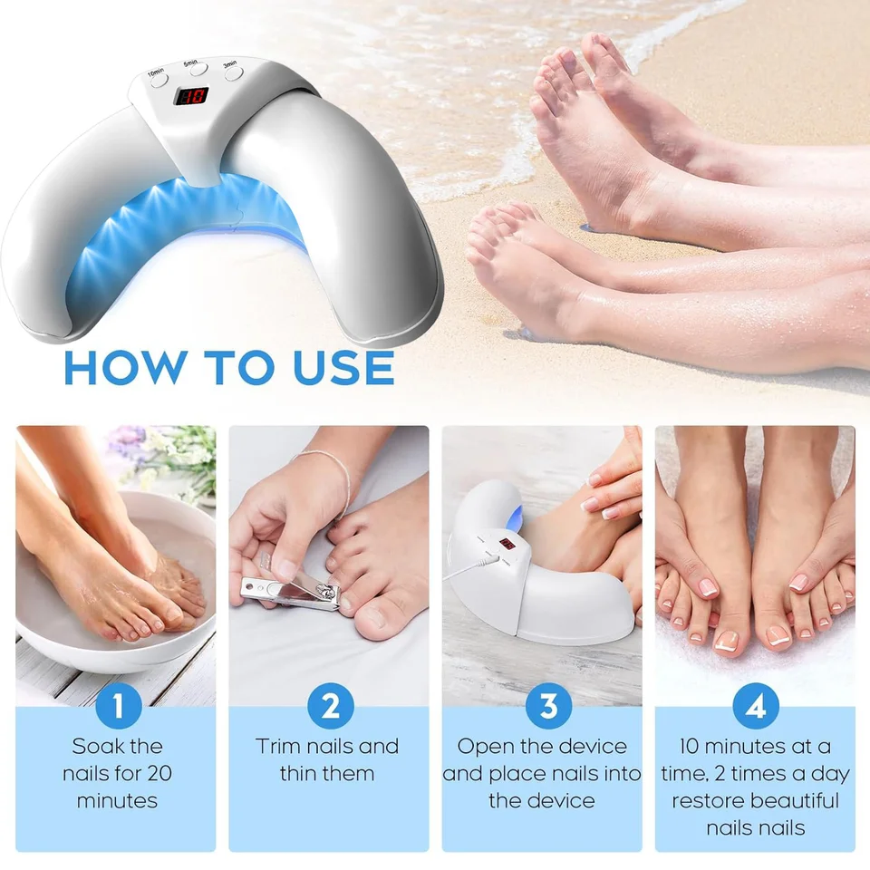 Nagellaserbehandelingsapparaat voor reparatie van teen- en vingernagelschimmel. Behandeling van onychomycose (nagelschimmel). Effectieve genezingsmachine voor het verwijderen van schimmels._voghion.com
