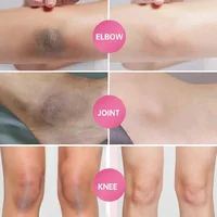 Whitening Cream For Dark Skin Armpit Thigh Inner Joint Lightening Intimate Area Underarm Body Care Private Parts Brighten Lotion 2