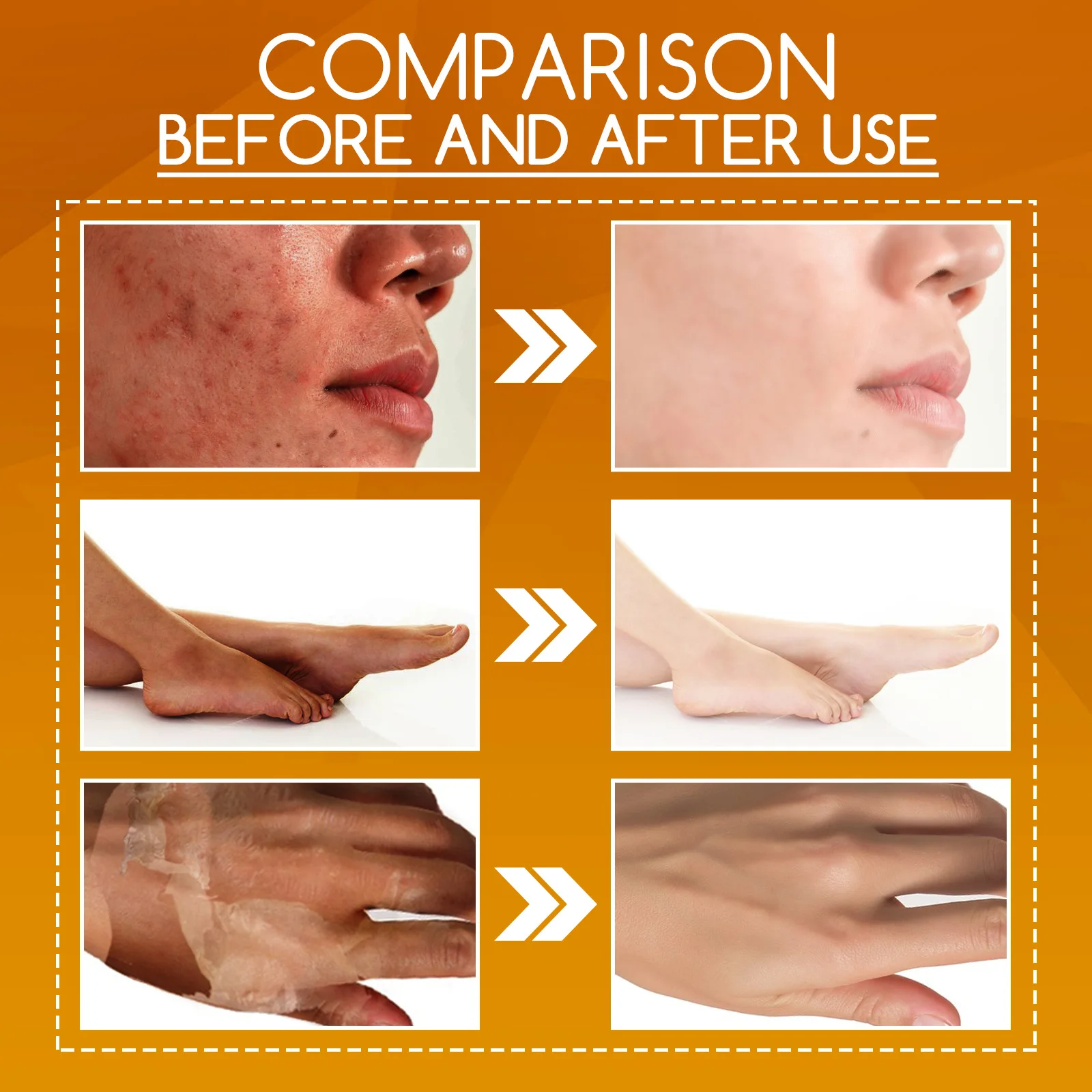 OUHOE Orange Peel Body Lotion Gentle exfoliation, lightening dark spots, whitening skin, moisturizing skin care solution