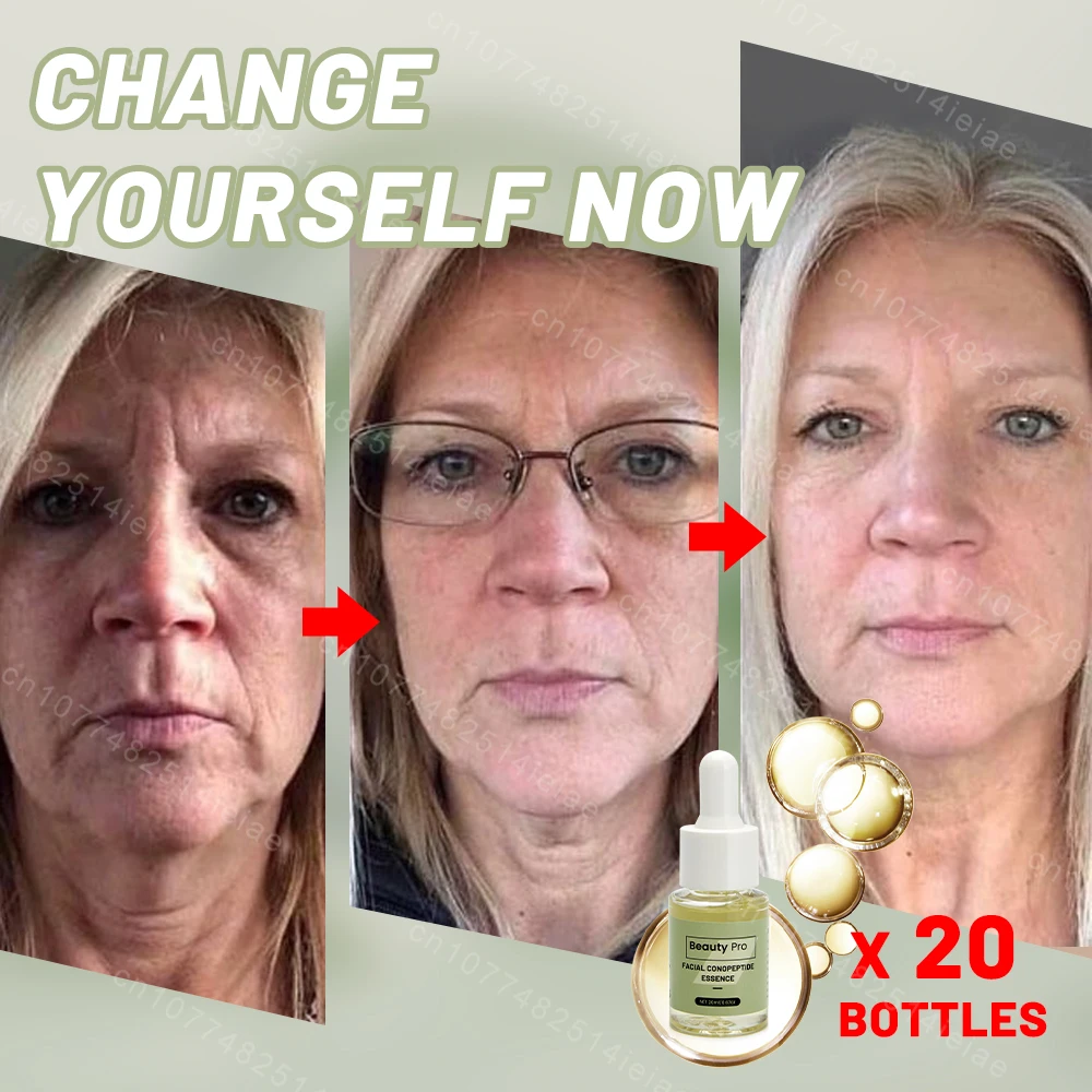 Facial Neck Hand Feet Anti-wrinkle Wrinkle Removal Essence Anti aging Serum Skin Care Lift Tighten Reduce Fine Lines Moisturize