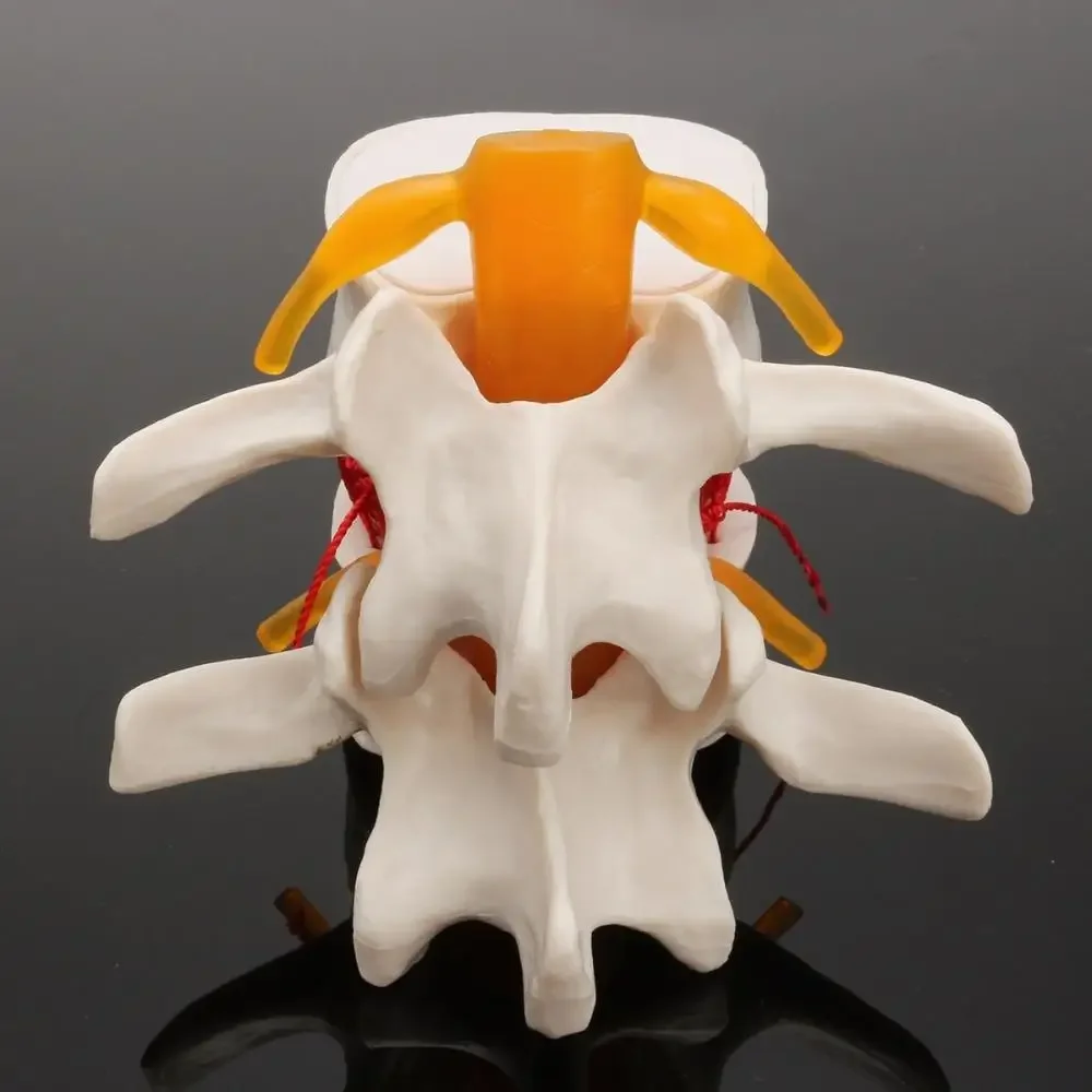 Human Anatomy Skeleton Spine Lumbar Disc Herniation Teaching Model Brain Skull Traumatic Pistol School Supplies Medical Instrument human skull model