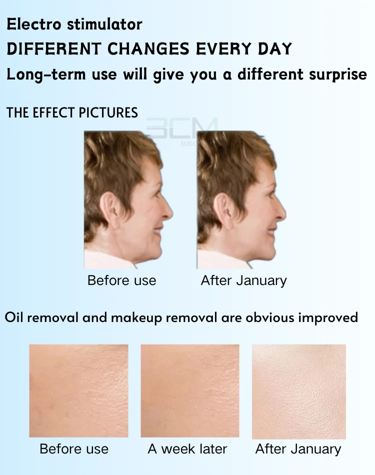 Non-Invasive Introduce Skincare Products Into the Skin DEEPBA Dermo Electro Poration Spa Machine