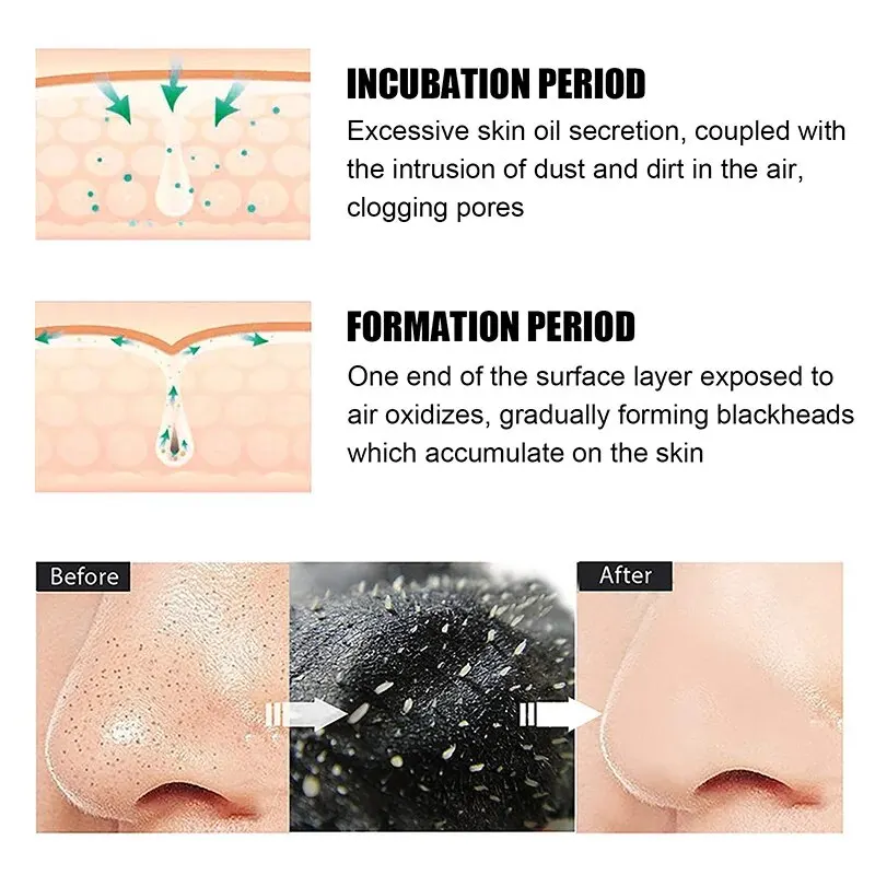 Black Pig Nose Stick Bamboo Charcoal To Remove Blackheads, Remove Acne, Clean Pores, Adsorb Oil And Dirt Nose Film Nose Stick 3