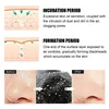 Black Pig Nose Stick Bamboo Charcoal To Remove Blackheads, Remove Acne, Clean Pores, Adsorb Oil And Dirt Nose Film Nose Stick 3