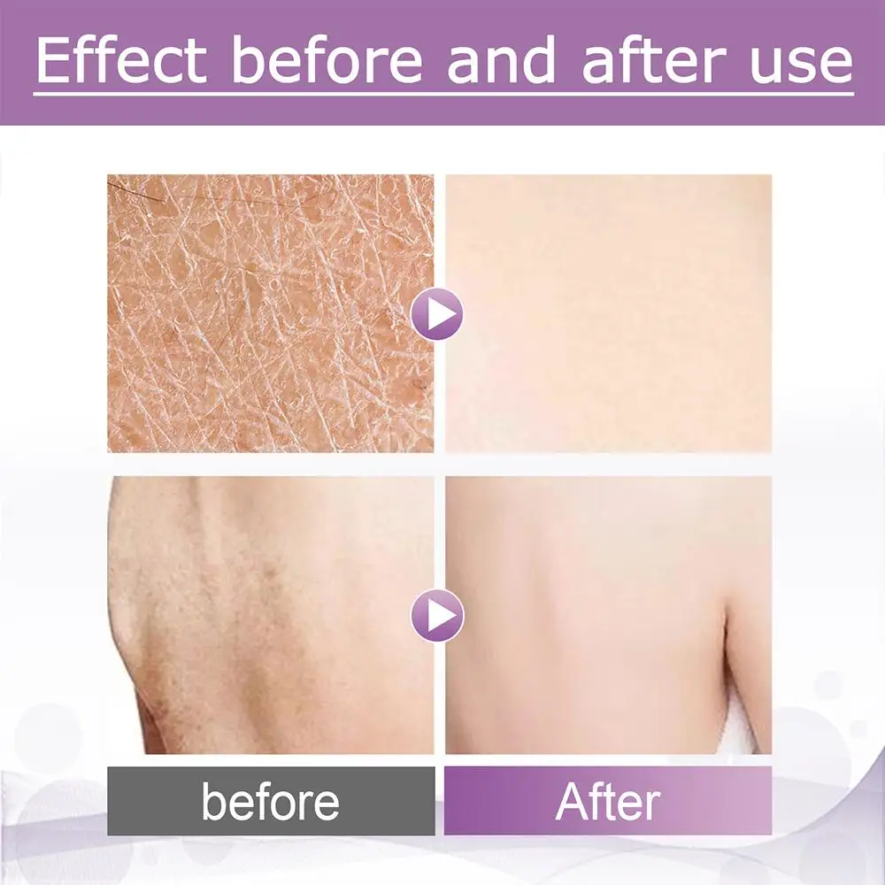 Рисунок 6 - Ластик-удар для тела