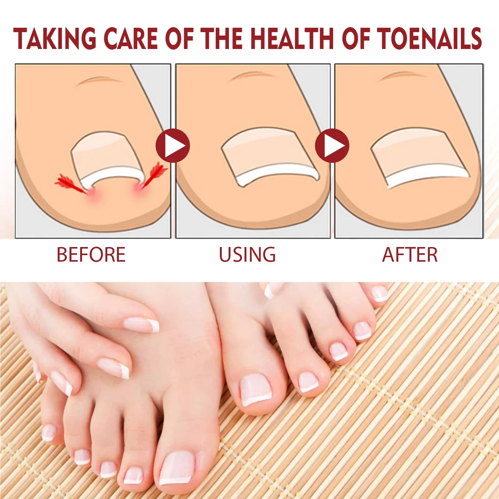 10ml Paronychial Sulcus Nursing Oil Repair Ingrown Armor Grey Nails Paronychial Sulcus Relieve Soft Armor Bright 발톱무좀