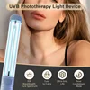 UVB 308NM  Phototherapy Lamp Device for Vitiligo Treatment UV NarrowBand Ultraviolet Light Therapy Psoriasis Spots Eczema 2