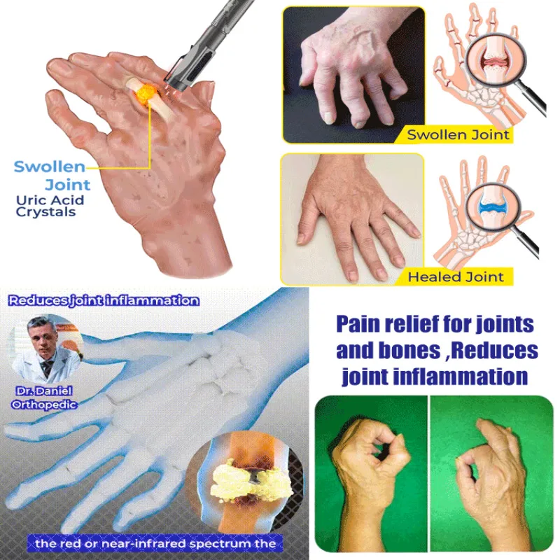 Joint care appliances Medical pen light Pen light Pen White and yellow joint care