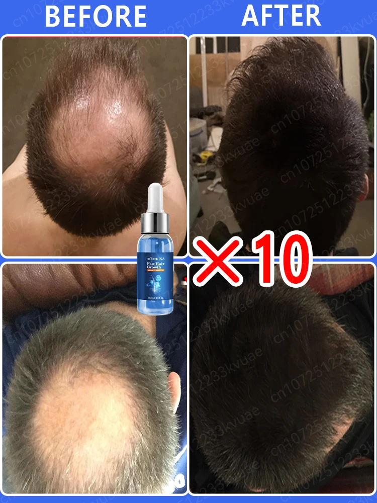 Grow back lost hair stop baldness loss in 7 days