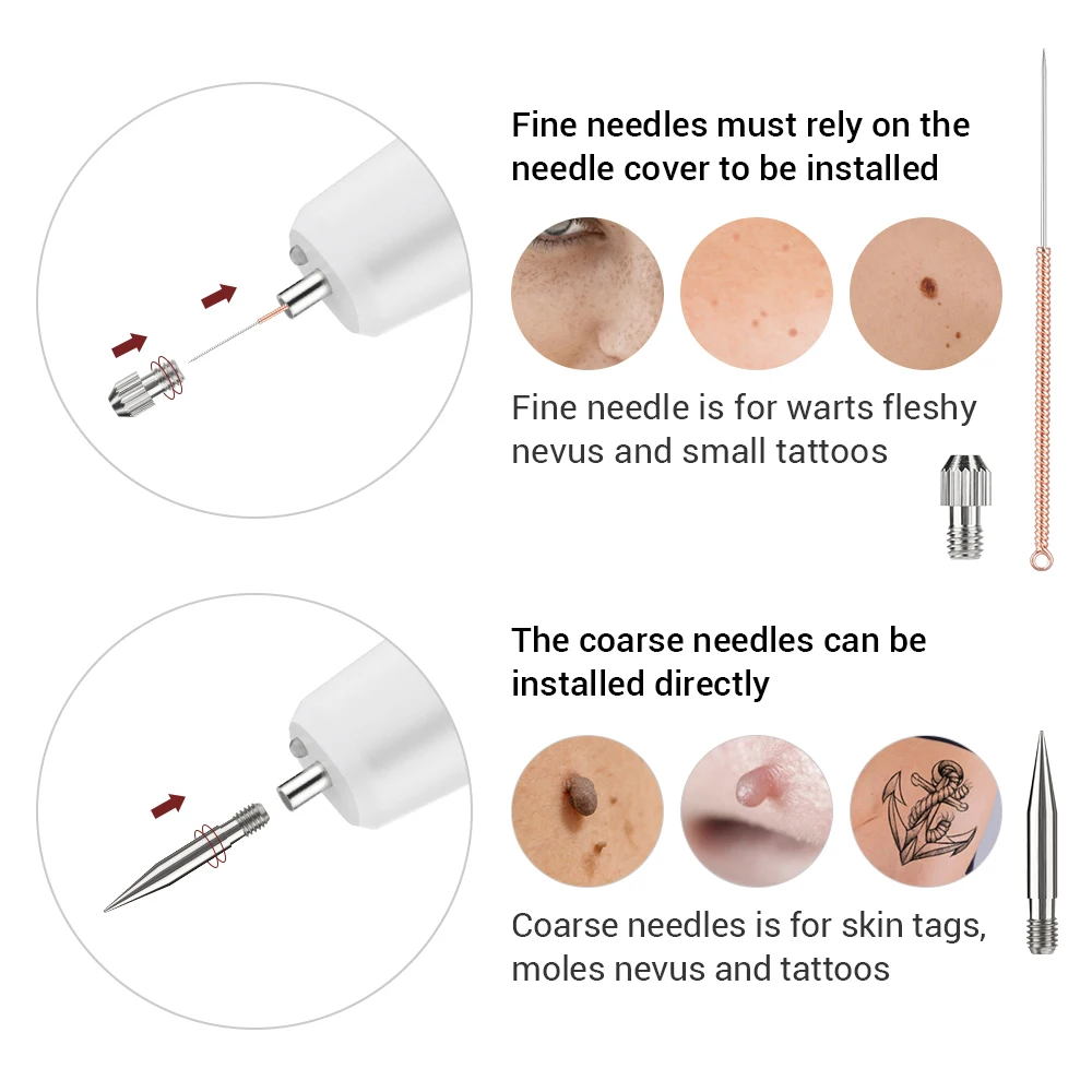 Laser Plasma Pen Mole Wart Eliminator Papilloma Skin Tag Remover Black Dots Freckle Dark Spot Remover Wireless Plasma Pen Beauty