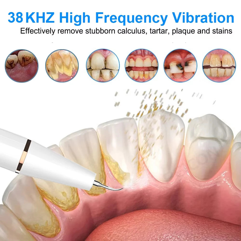 Dental Calculus Scaler Ultrasonic Dental Tartar Remover Electric Ultra Sonic Dental Calculus Plaque Removal Scaler Tartar Eliminator dental calculus scaler