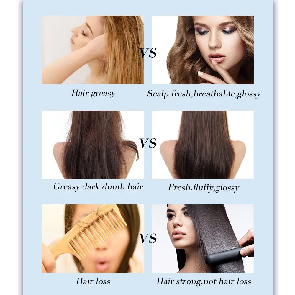 Fast Hair Growth Shampoo Nourishing Repair Shampoo Reduce Hair Dry Improves Hair Quality Anti Hair Loss Care Product 150ml