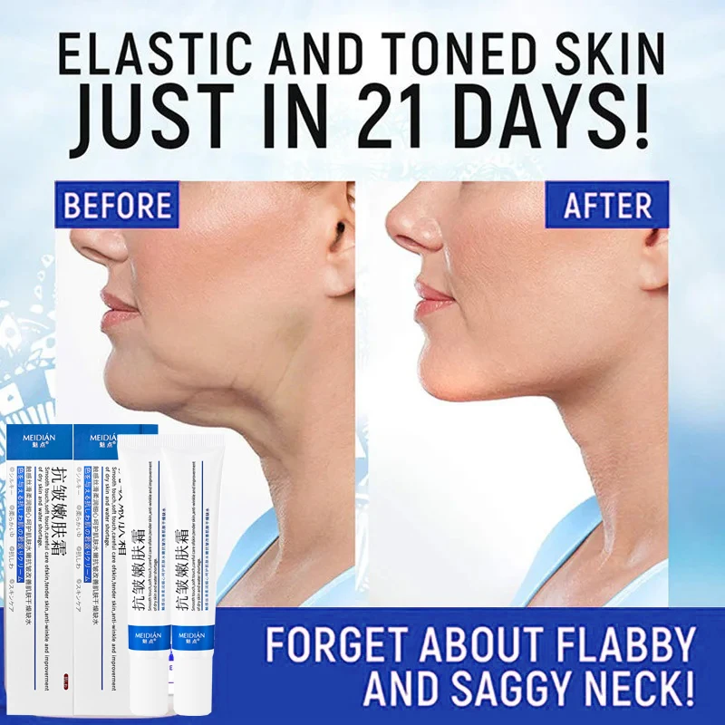 Neck Cream Collagen Eliminate Neck Wrinkle Lines Lifting Whitening Tighten Double Chin Anti-age Rejuvenation Skin Care Product