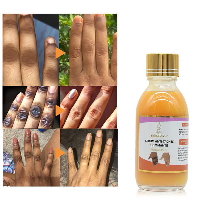 5D Gluta Szerves Vitamin E És Kollagén-Taches Hidratáló Test Csukló Fehérítő Szérum 125 Ml Sötét Foltokhoz - Image 6