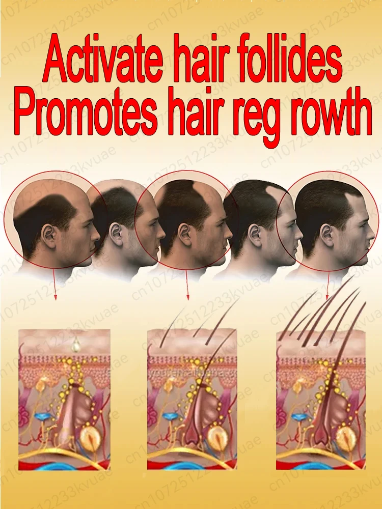 Produits croissance des cheveux dites adieu calvitie perte de cheveux 99% avis positifs