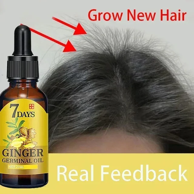 Biotin Ginger Hair Growth Oil, Hair Thicker Essence For Men & Women, Hair Regrowth Treatment For Stronger Thicker Longer