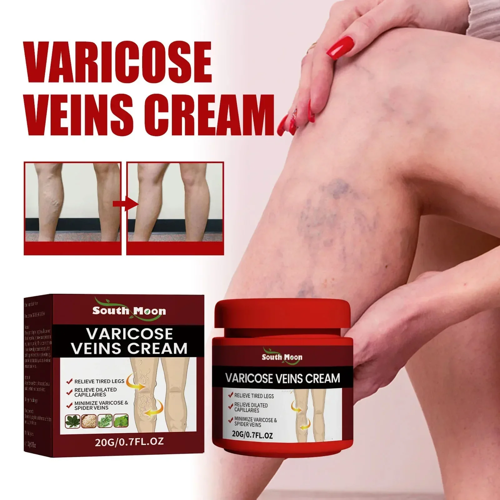 Varicose Veins Relief Cream Vasculitis Phlebitis Spider Pain Relief Ointment Medical Plaster Varicose Veins Treatment Body Cream