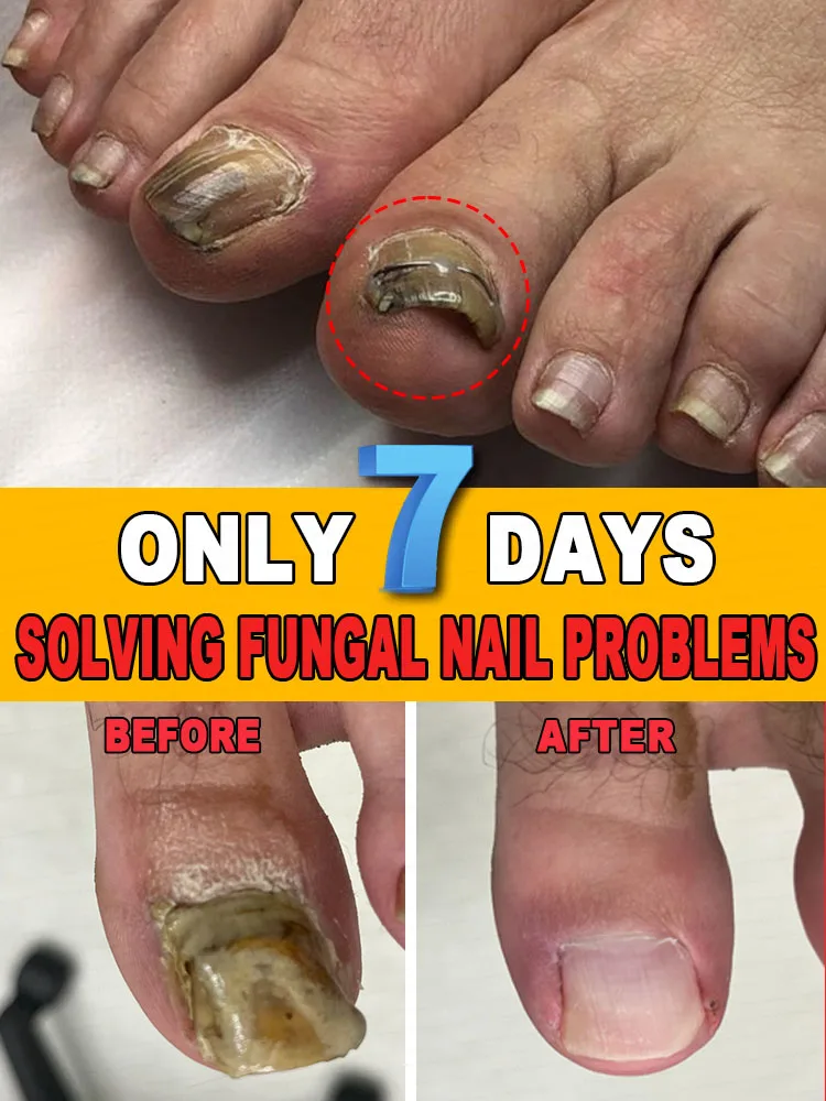 nail