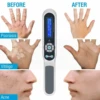 308nm Handheld uvb Light Therapy Portable Effective To Treat vitiligo Psoriasis Eczema Uvb Lamps Uv Phototherapy Instrinstrument 3