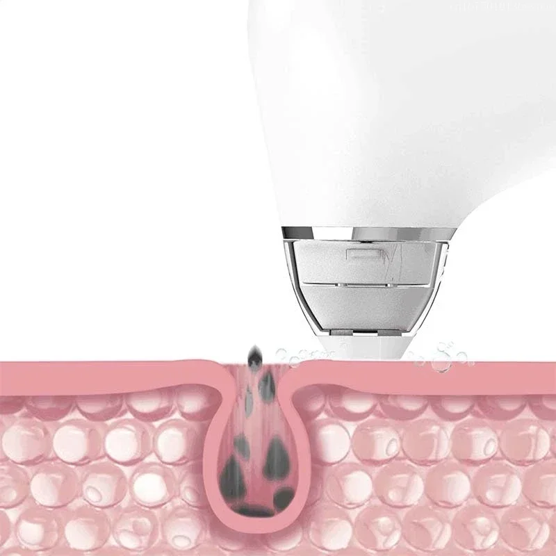 Xiaomi DOCO Ultra-Micro Bubble Pore Vacuum Cleaner Electric Acne Machine Blackhead Remover Facial Beauty Skin Cleansing Tool