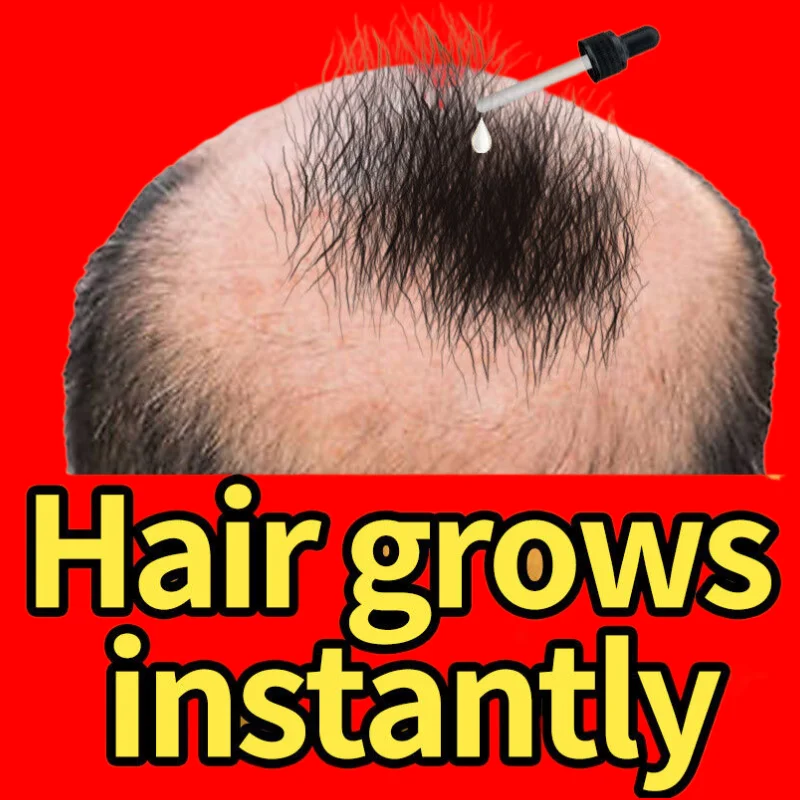 FastHairGrowthProductsHairRegrowthEssentialOilsAntiHairLoss