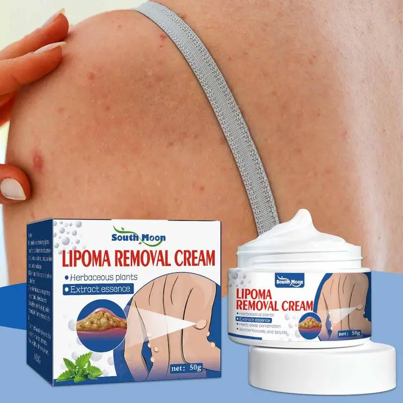 Lipoma Removal Cream The Whole Body Multiple Subcutaneous Conditioning Cream Eliminate Paste Fiber Paste Skin Care 50g