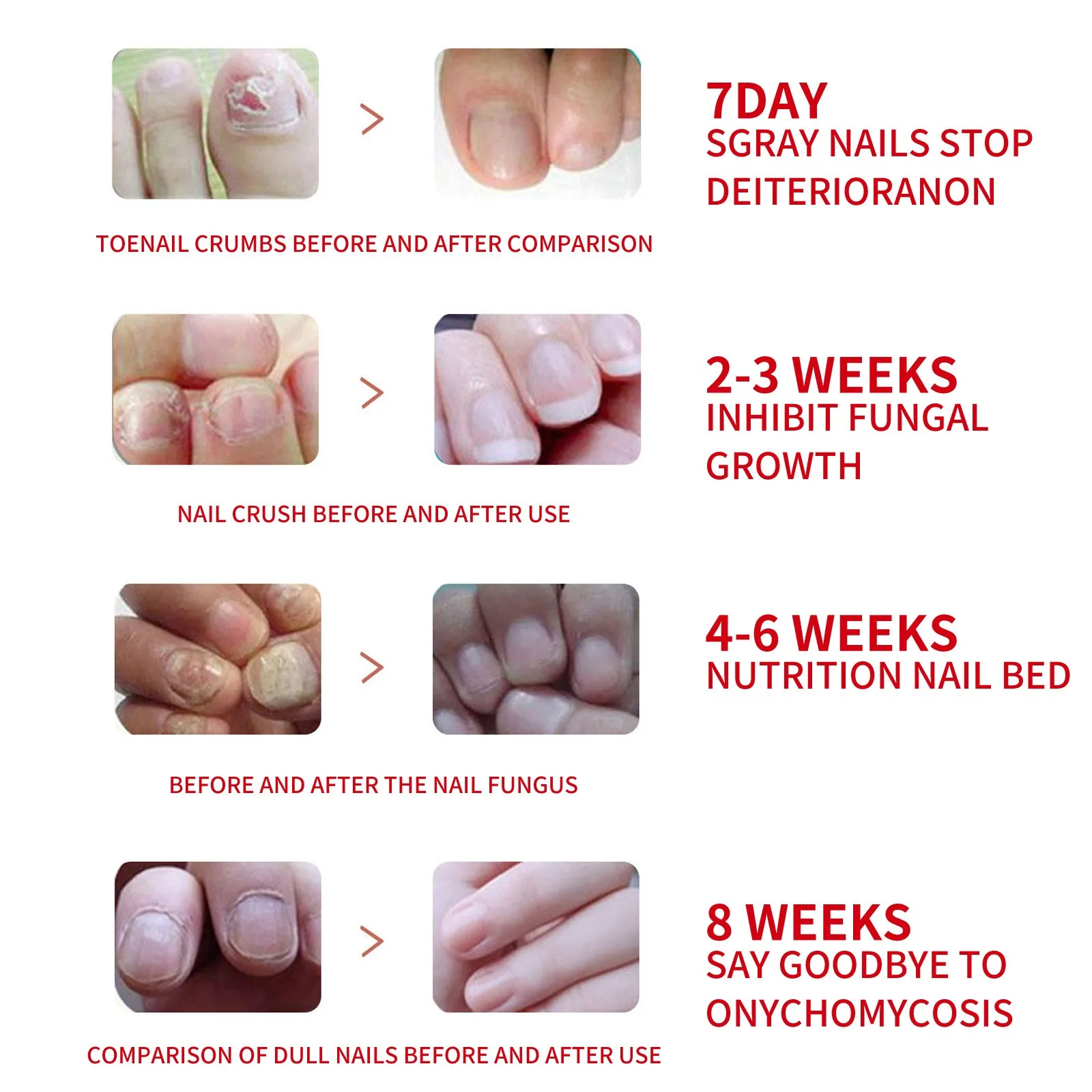 20ml Nail Repairing Liquid Fungus Treatment Essence skin care products,skin care essence,nail fungus repair device