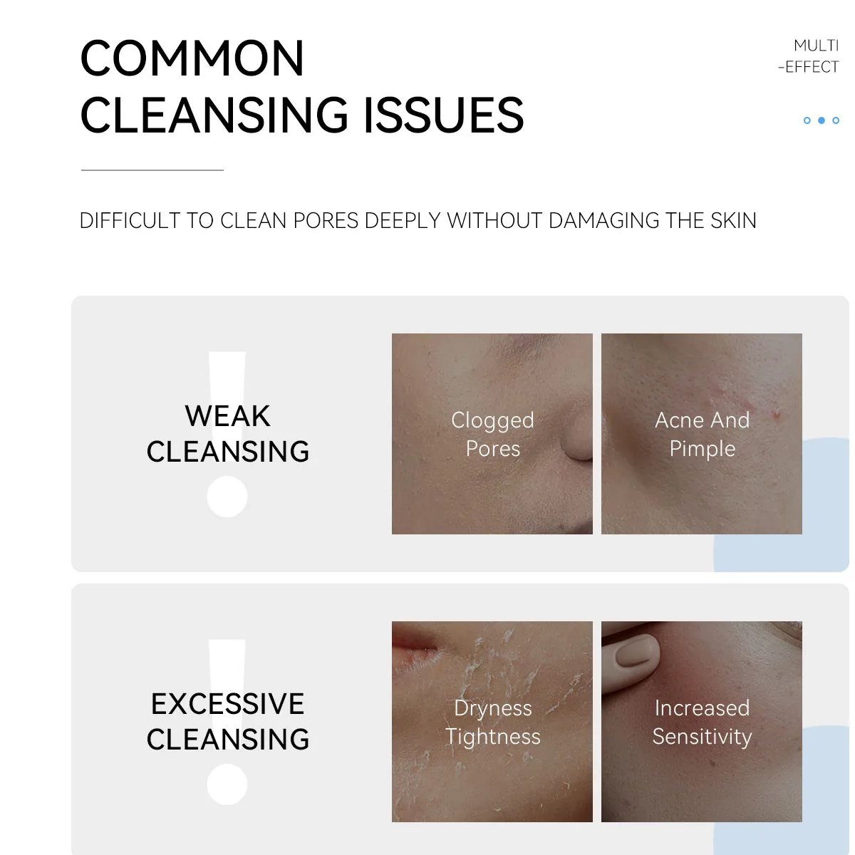Deep Cleansing Facial Foam Gel Oil Control Acne Mark Removal Pore Refining Blackhead Eliminator Face Wash for Clearer Skin