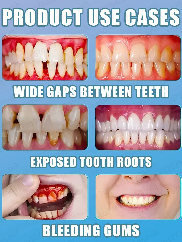 Tooth restoration gum strengthening healthy teeth dental mirror