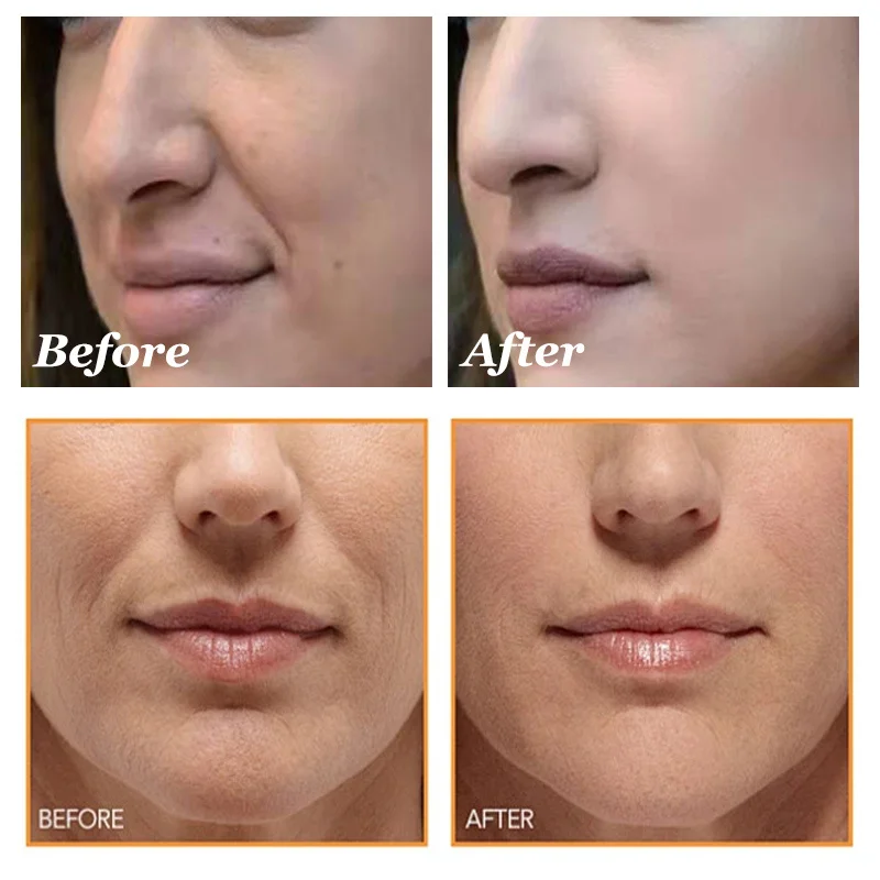 Dragon Blood Wrinkle Remover Face Set Instant Firming Lifting Anti-Aging Serum Fade Fine Line Whitening Korean Skin Care Product 2