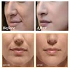 Dragon Blood Wrinkle Remover Face Set Instant Firming Lifting Anti-Aging Serum Fade Fine Line Whitening Korean Skin Care Product 2
