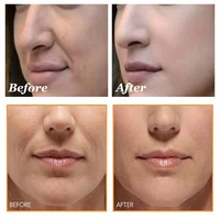 Dragon Blood Wrinkle Remover Face Set Instant Firming Lifting Anti-Aging Serum Fade Fine Line Whitening Korean Skin Care Product 2