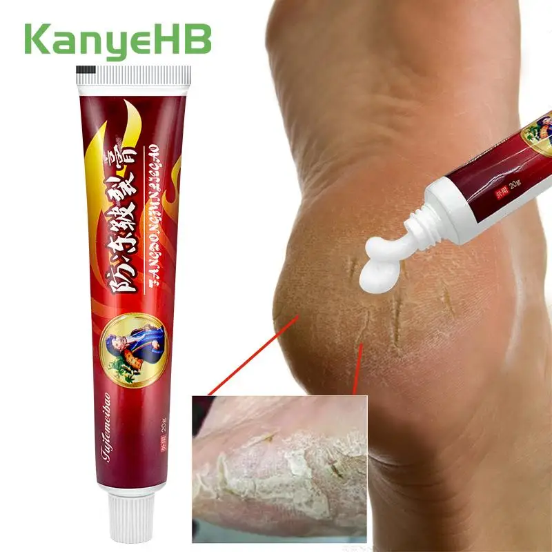 

1Pcs Anti-Drying Crack Foot Cream Heel Cracked Repair Cream Removal Dead Skin Hand Feet Care Chinese Herb Medicine Ointment S101