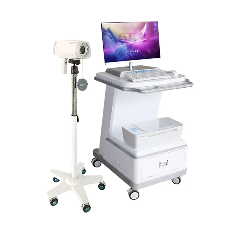 

Economical Camera Cmos Colposcope Appareil Software Colposcopy Device