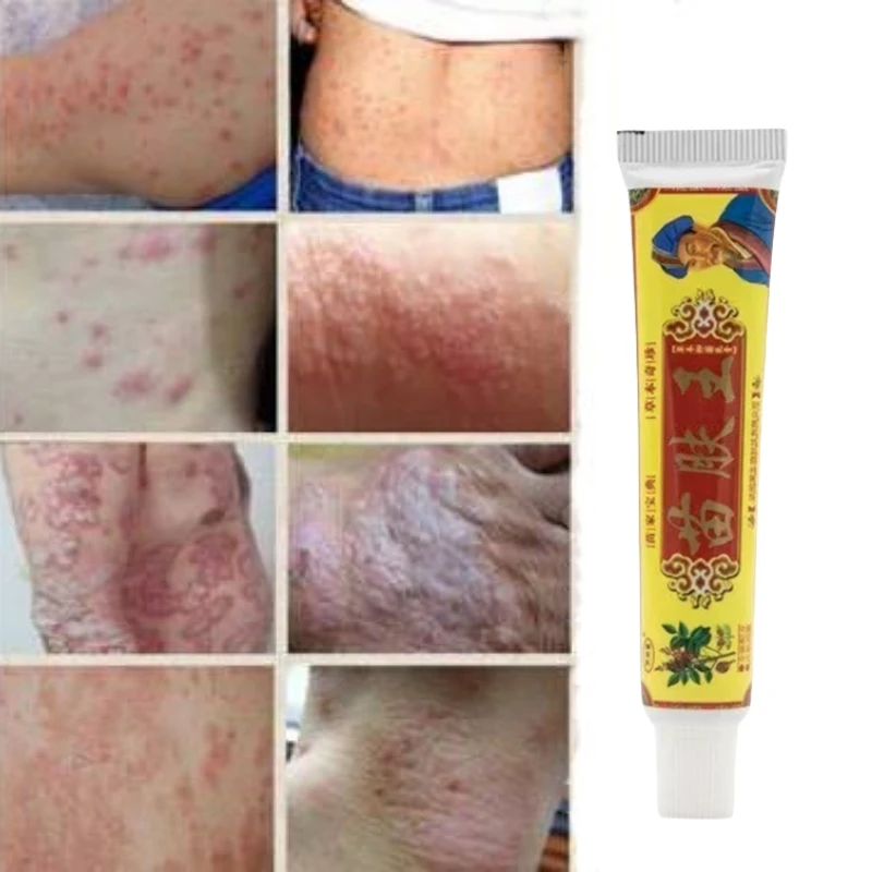 

Anti Itch Cream Private Part Cream Remove Odor Funguss Antibacterial Deodorant Pruritus Dermatitis Anti-itch Health Care