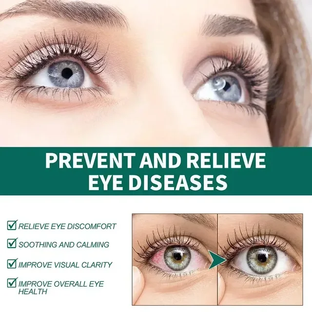 Eye Drops Relieves Eyes Discomfort Blurred Eyes Sore Eye Care Itchy Relax Dry Swelling Massage Clean 5