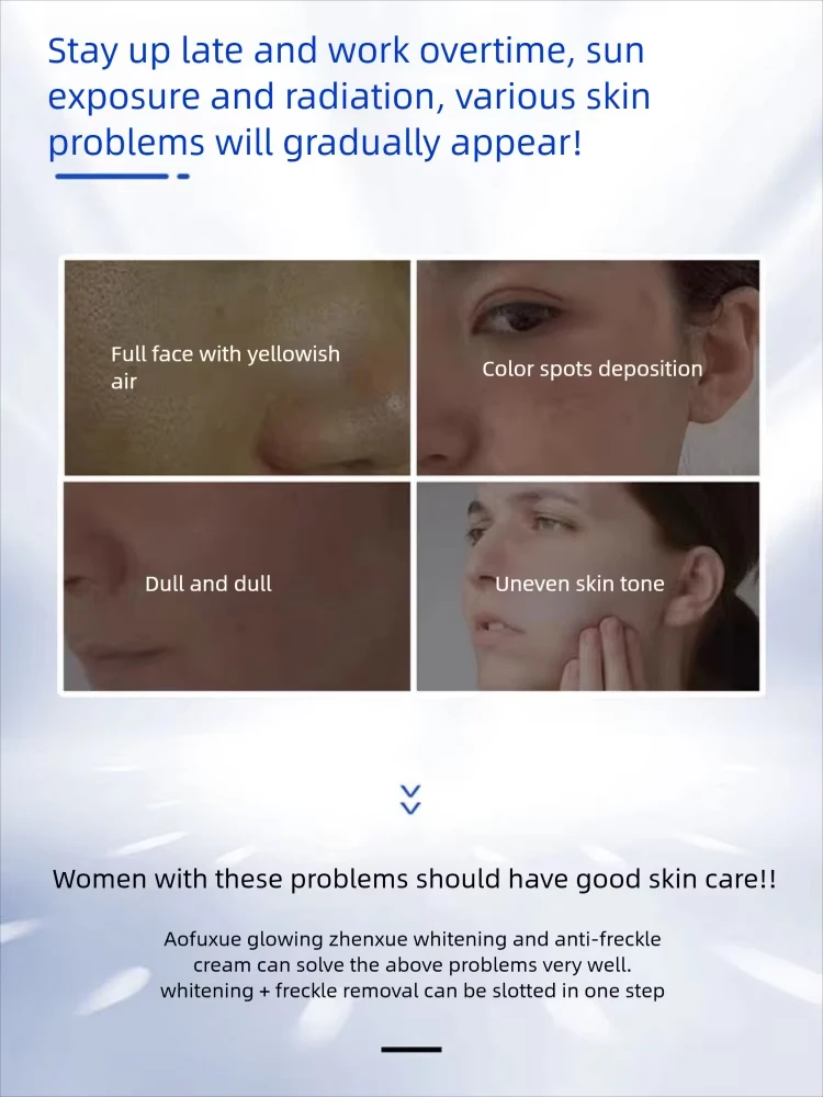 كريم تبييض النمش يزيل الكلف البقع الداكنة مصحح تفت...