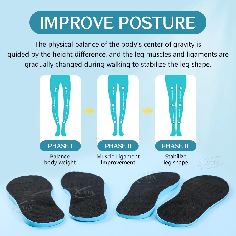 【Xxin】Men Women X leg Correction Insoles Orthopedic Shoe Pads O leg Insole Flat Arch Shoe Inserts Size 35-46