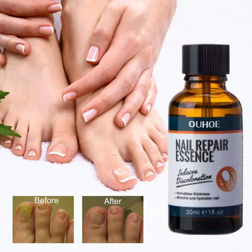 Non irritating Natural Ingredients Reduce Dry Brighten Hand Foot Toes