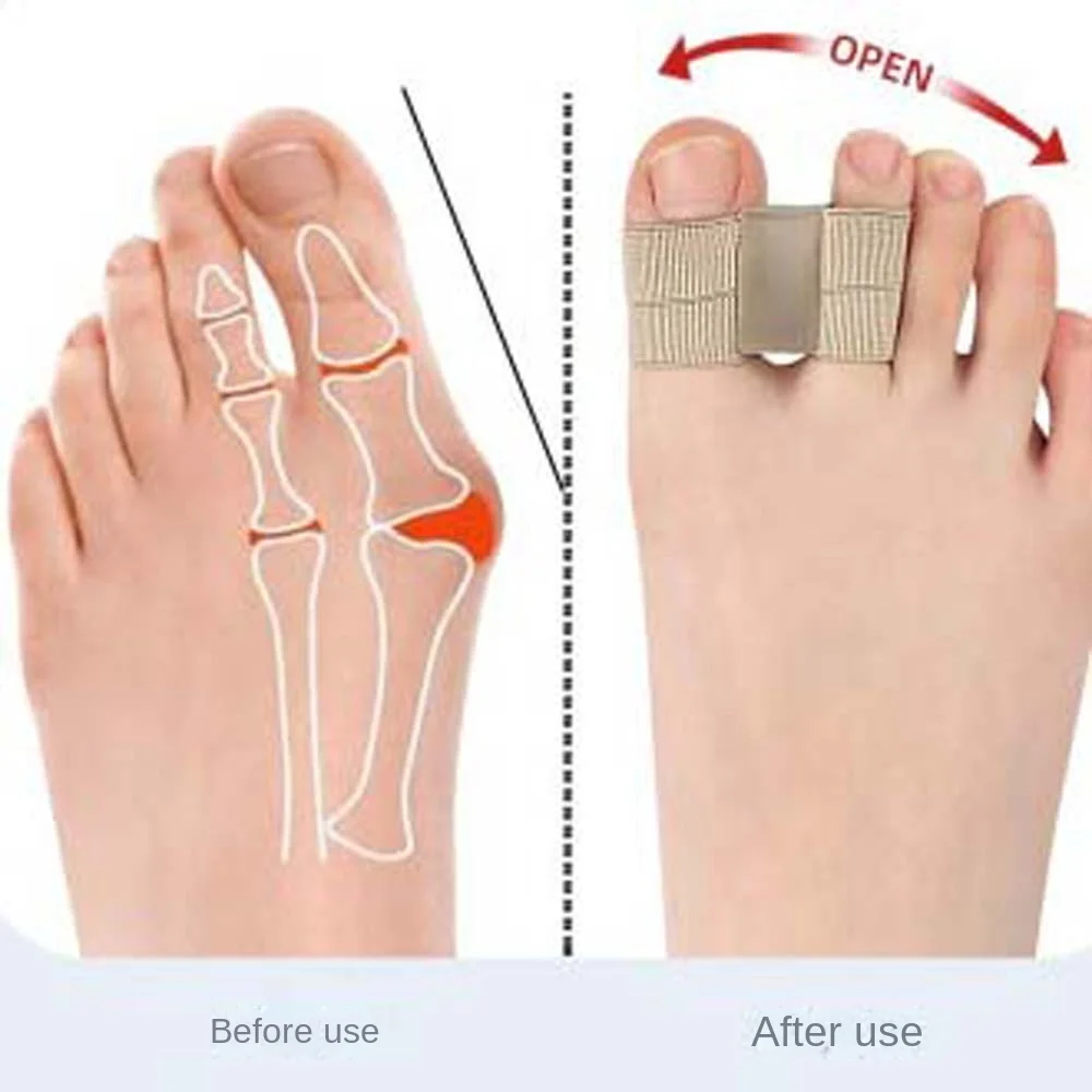 SEBS Toe Straightener Pedicure Tool Foot Care Toe Separators Orthotics Brace Bunion Protector Valgus Corrector Household