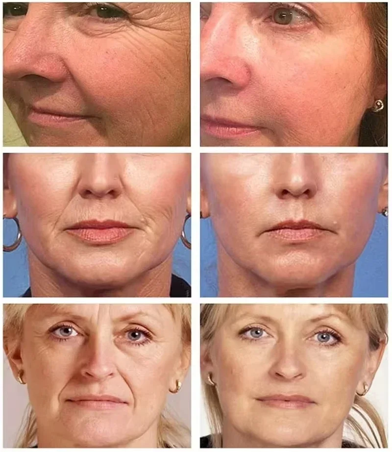 V89 probiotic facial essence, young skin 3