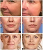 V89 probiotic facial essence, young skin 3