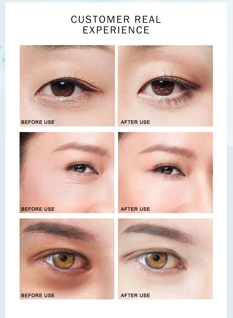ARTISCARE Eye patches Hyaluron Acid & Gold & Seaweed & Black Pearl Anti Wrinkle Dark Circles Crystal Collagen Gel Eye Masks