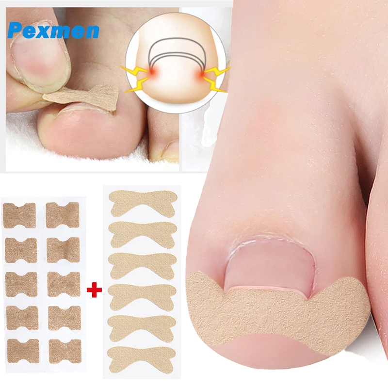 Pexmen 16Pcs/2Sheets Ingrown Toenail Correction Sticker Adhesive Toenail Patch Elastic Nail Treatment Corrector Foot Care Tool