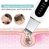Ultrasonic Skin Scrubber Peeling Acne Blackhead Remover Ultrasonic EMS Ion Acne Pore Face Deep Cleaning Facial Shovel Cleaner 4