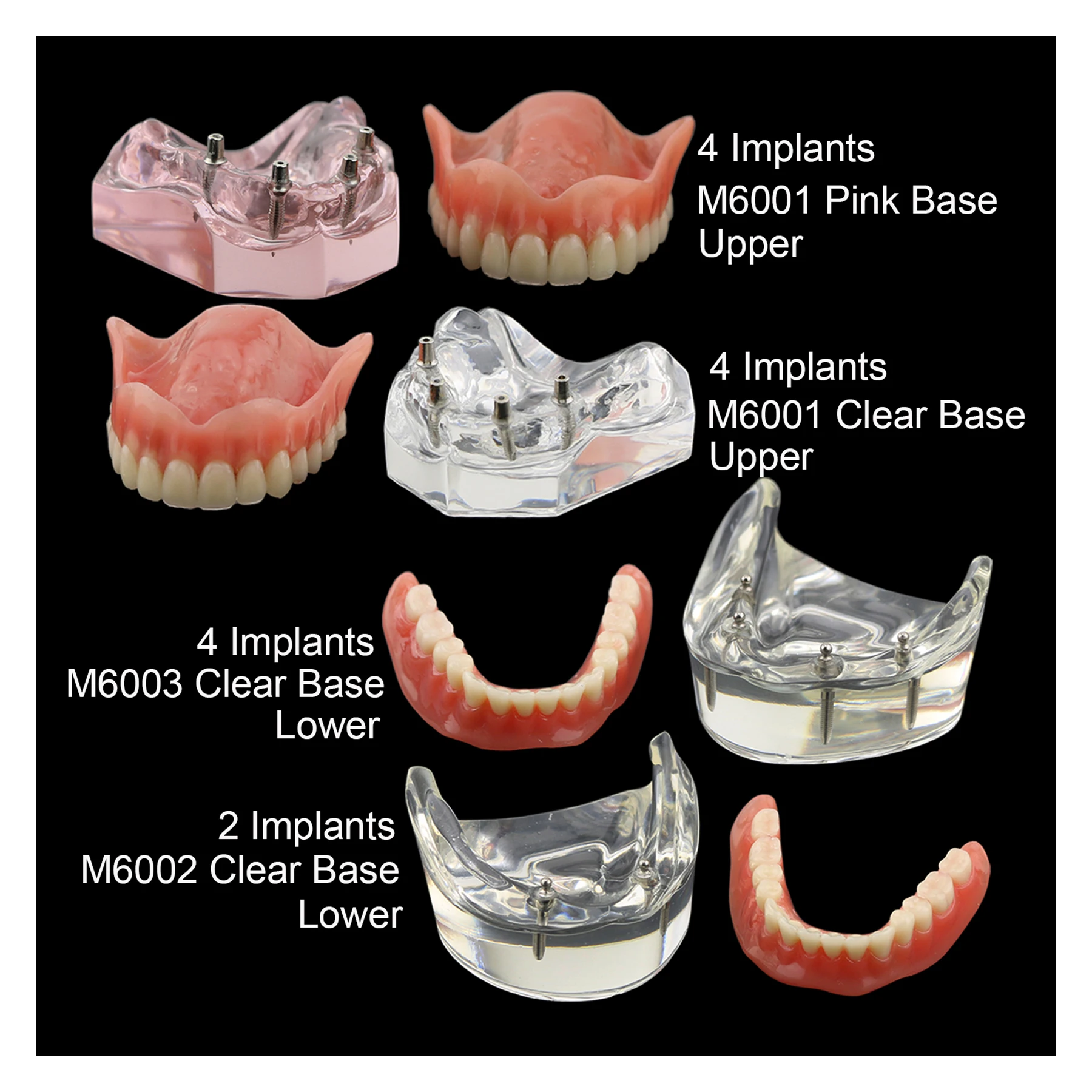 

Dental Implant Typodont Teeth Model Overdenture 2 4 Implants Superior Upper Lower Inferior Restoration Demo For Teach Study