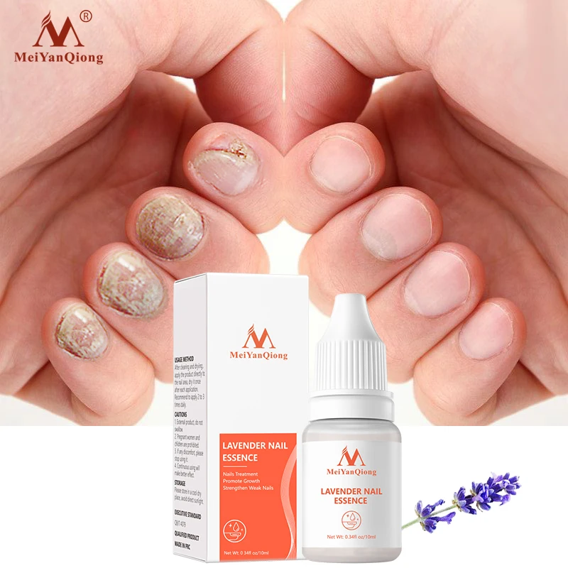 Fungal Nail Treatment Feet Care Essence Removal Fungus Healthy Repair