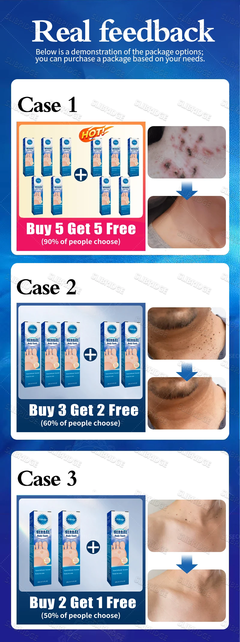 Flacone blu sicuro ed efficace per rimuovere le verruche, strumenti per il corpo, congelamento delle verruche._voghion.com