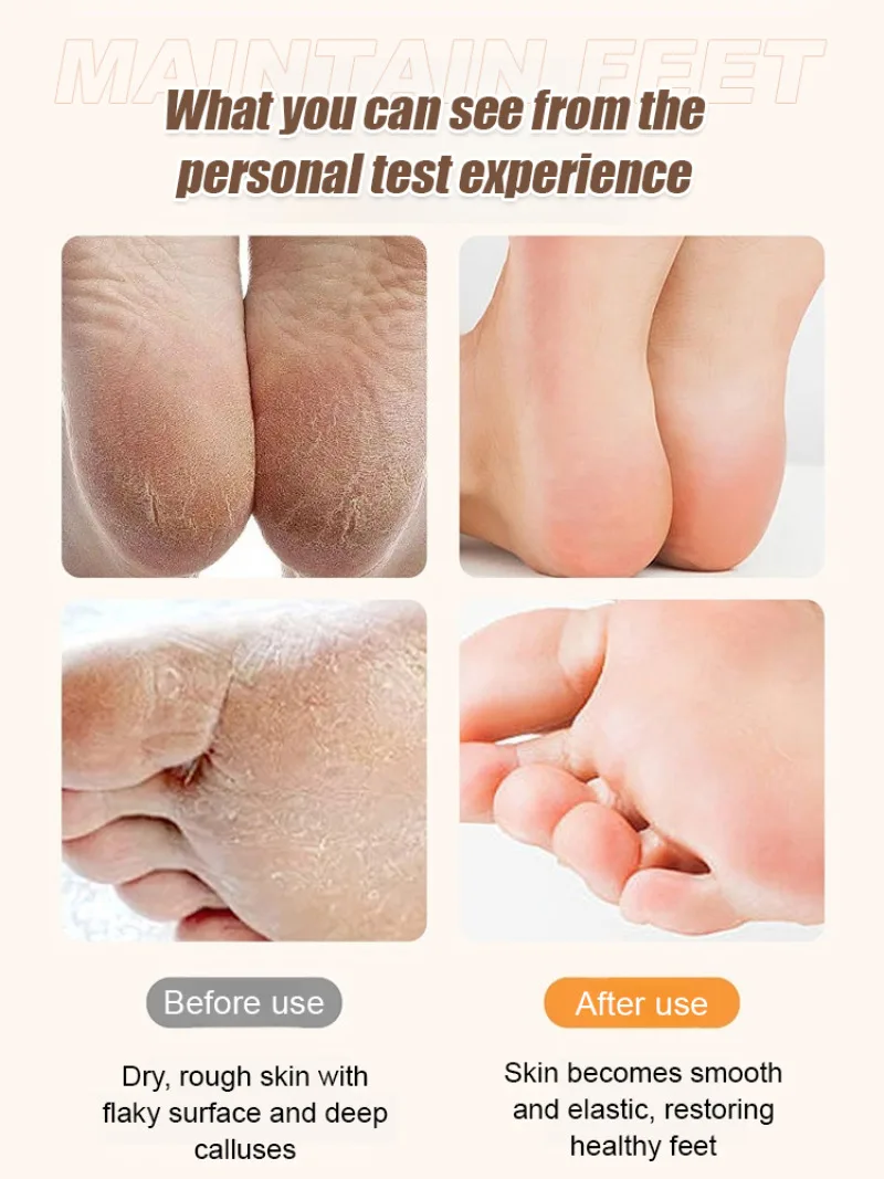 Household electric foot grinder automatic beauty foot pedicure rechargeable dead skin callus grinder 4