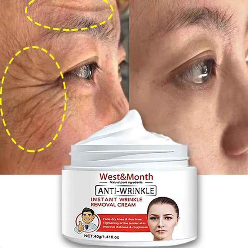 

40g Remove Wrinkle Anti-Aging Fade Fine Lines Face Whitening Brighten Skin Beauty Health Care Retinol Lifting Firming CreamSpot